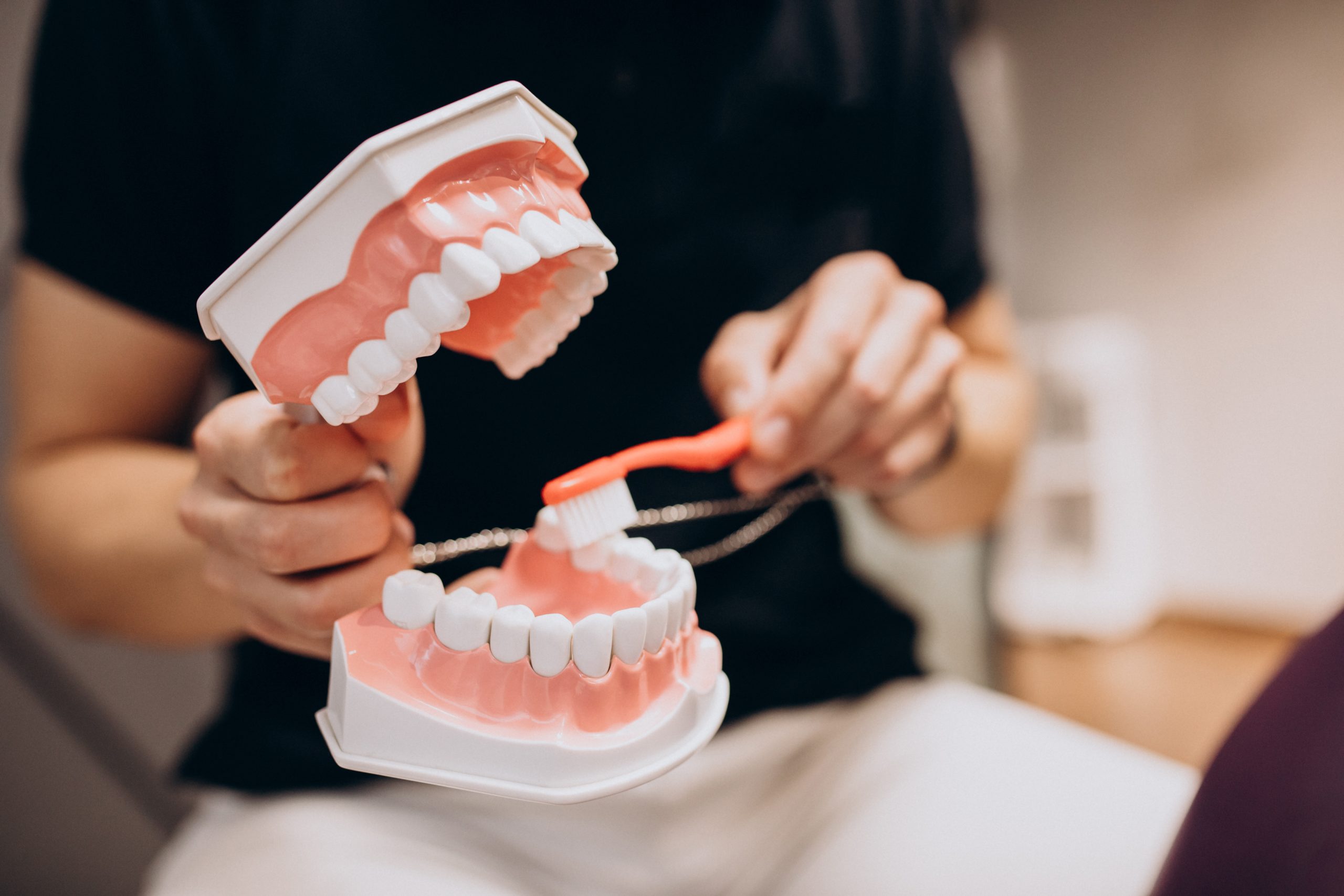 Modello dentale usato per spiegare l'igiene orale e la prevenzione