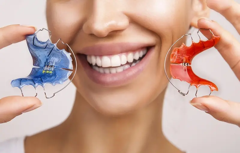 Esempio di apparecchio mobile per ortodonzia - OrthoSmile, studio dentistico a Rho