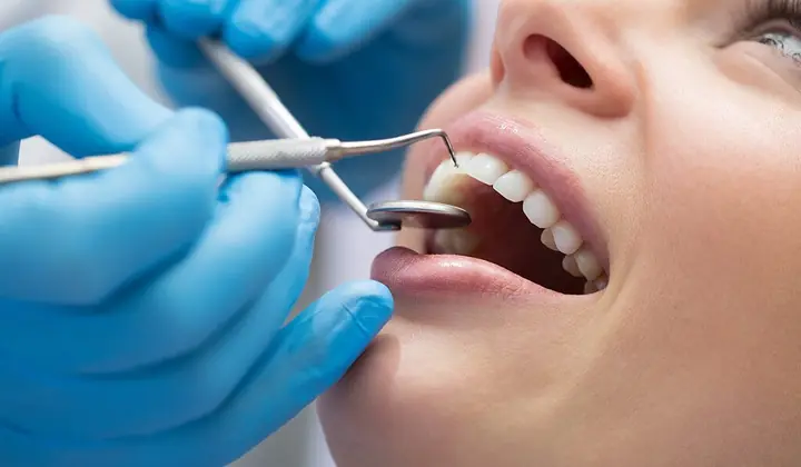 Modello dentale utilizzato per spiegare i tessuti parodontali