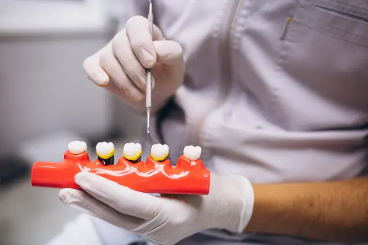 Strumenti e modello per protesi dentali